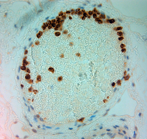 MPO Antibody in Immunohistochemistry (Paraffin) (IHC (P))