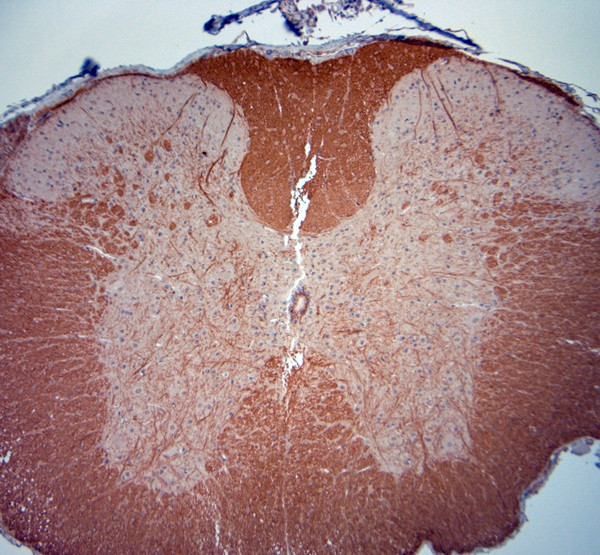 MBP Antibody in Immunohistochemistry (Paraffin) (IHC (P))