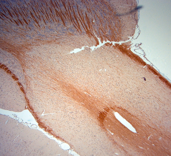 MBP Antibody in Immunohistochemistry (Paraffin) (IHC (P))