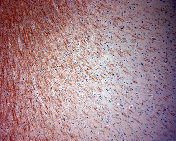 MBP Antibody in Immunohistochemistry (Paraffin) (IHC (P))