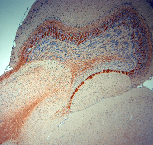 MBP Antibody in Immunohistochemistry (Paraffin) (IHC (P))