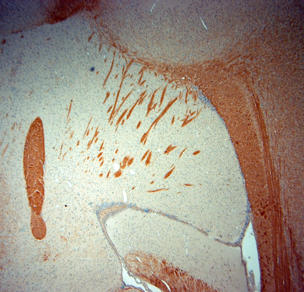 MBP Antibody in Immunohistochemistry (Paraffin) (IHC (P))