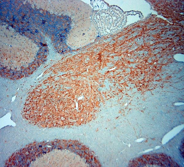 MAP2 Antibody in Immunohistochemistry (Paraffin) (IHC (P))