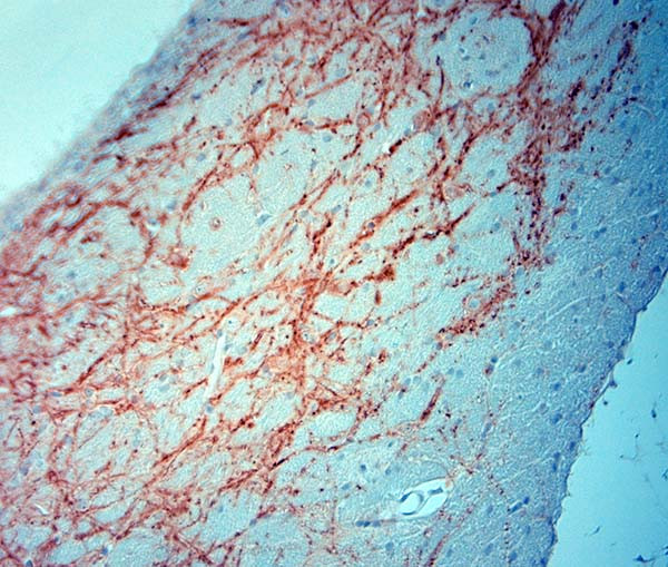 MAP2 Antibody in Immunohistochemistry (Paraffin) (IHC (P))