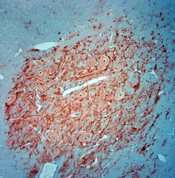 MAP2 Antibody in Immunohistochemistry (Paraffin) (IHC (P))