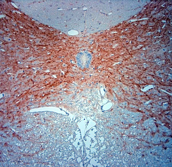 MAP2 Antibody in Immunohistochemistry (Paraffin) (IHC (P))