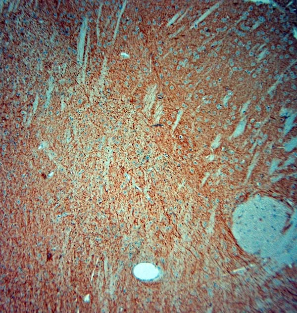 MAP2 Antibody in Immunohistochemistry (Paraffin) (IHC (P))