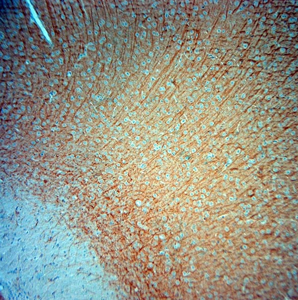 MAP2 Antibody in Immunohistochemistry (Paraffin) (IHC (P))