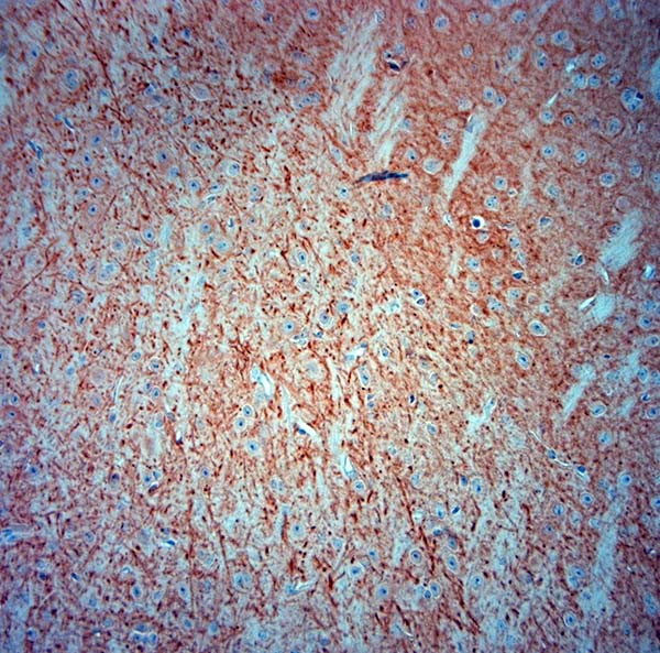 MAP2 Antibody in Immunohistochemistry (Paraffin) (IHC (P))