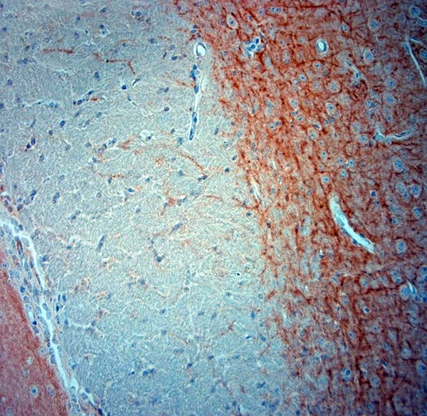 MAP2 Antibody in Immunohistochemistry (Paraffin) (IHC (P))