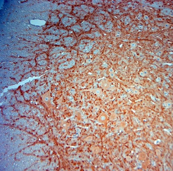 MAP2 Antibody in Immunohistochemistry (Paraffin) (IHC (P))