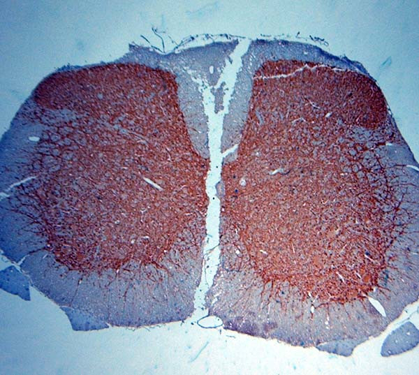 MAP2 Antibody in Immunohistochemistry (Paraffin) (IHC (P))