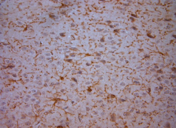 NG2 Antibody in Immunohistochemistry (Paraffin) (IHC (P))