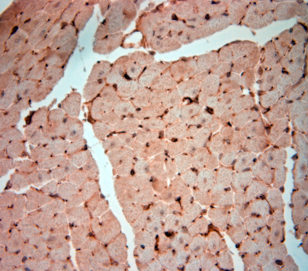 NG2 Antibody in Immunohistochemistry (Paraffin) (IHC (P))