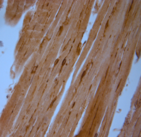 NG2 Antibody in Immunohistochemistry (Paraffin) (IHC (P))