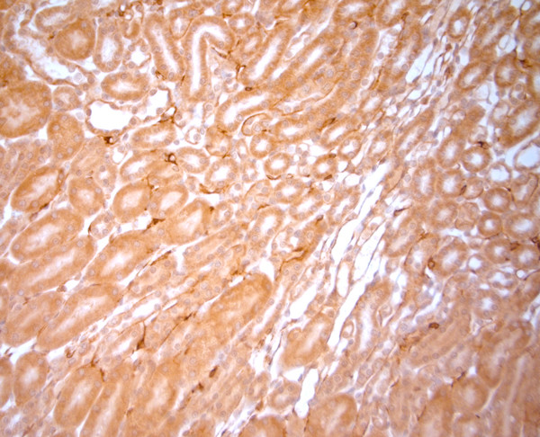 NG2 Antibody in Immunohistochemistry (Paraffin) (IHC (P))