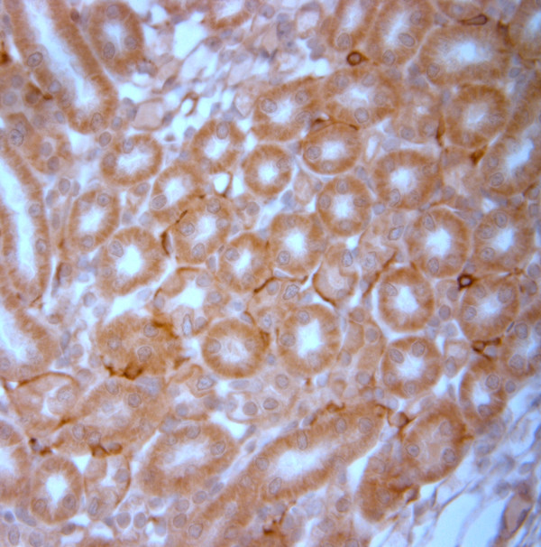 NG2 Antibody in Immunohistochemistry (Paraffin) (IHC (P))