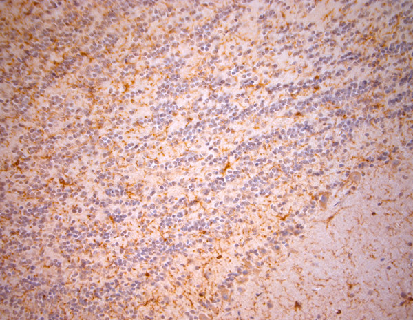 NG2 Antibody in Immunohistochemistry (Paraffin) (IHC (P))