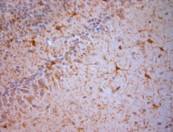 NG2 Antibody in Immunohistochemistry (Paraffin) (IHC (P))