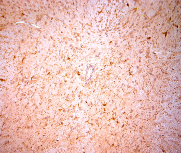 NG2 Antibody in Immunohistochemistry (Paraffin) (IHC (P))