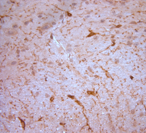 NG2 Antibody in Immunohistochemistry (Paraffin) (IHC (P))