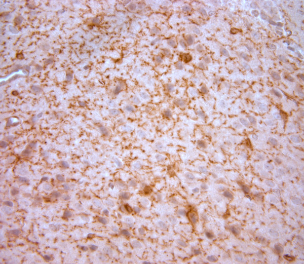 NG2 Antibody in Immunohistochemistry (Paraffin) (IHC (P))