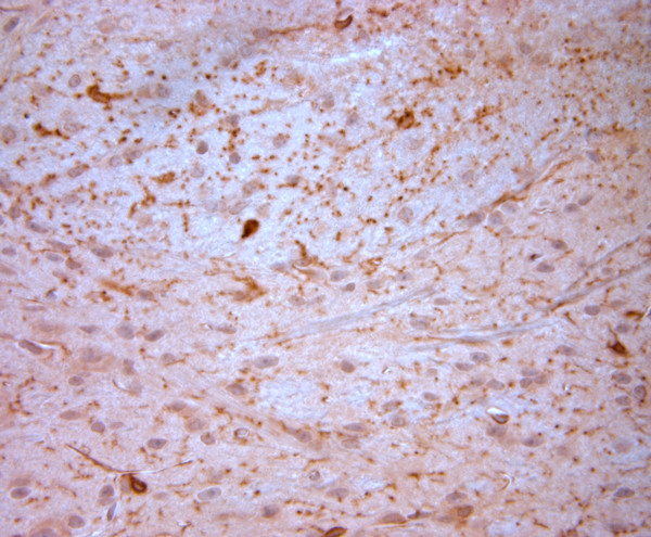 NG2 Antibody in Immunohistochemistry (Paraffin) (IHC (P))