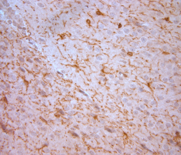 NG2 Antibody in Immunohistochemistry (Paraffin) (IHC (P))