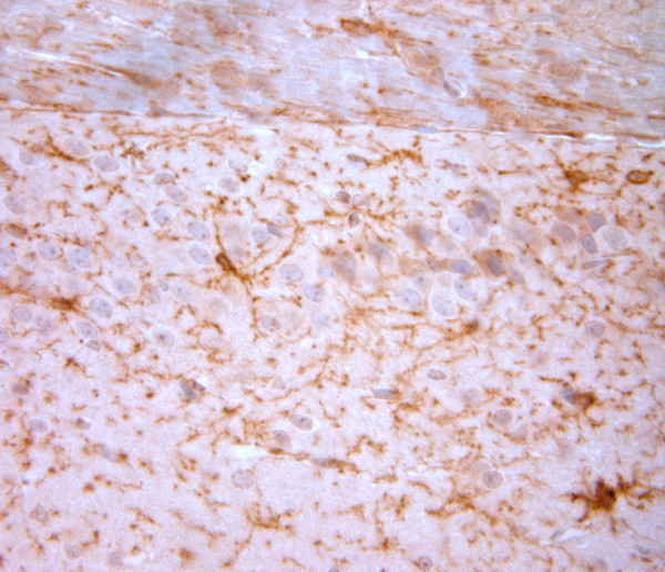 NG2 Antibody in Immunohistochemistry (Paraffin) (IHC (P))