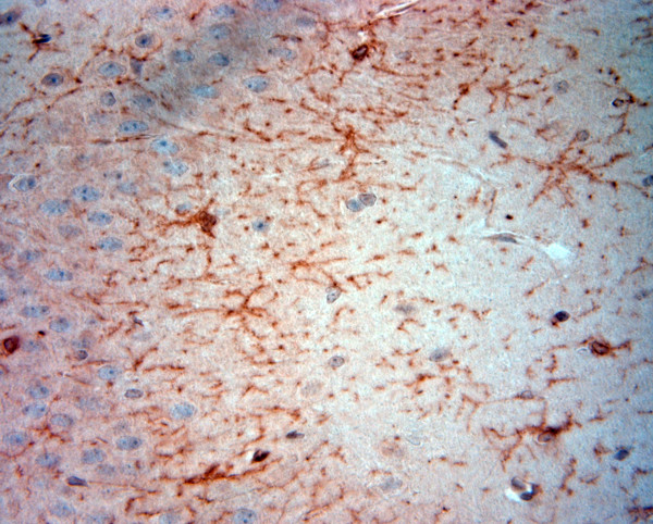 NG2 Antibody in Immunohistochemistry (Paraffin) (IHC (P))