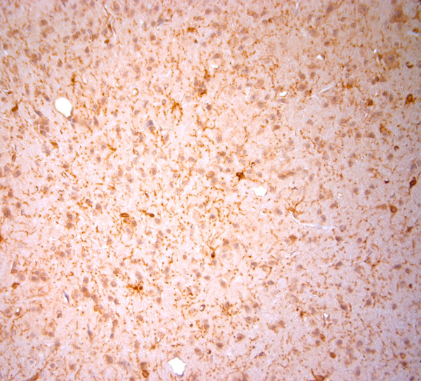 NG2 Antibody in Immunohistochemistry (Paraffin) (IHC (P))