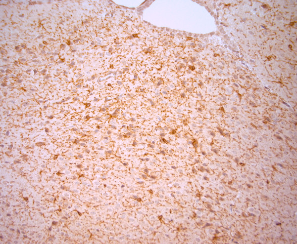 NG2 Antibody in Immunohistochemistry (Paraffin) (IHC (P))