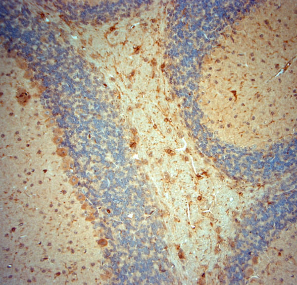 NG2 Antibody in Immunohistochemistry (Paraffin) (IHC (P))