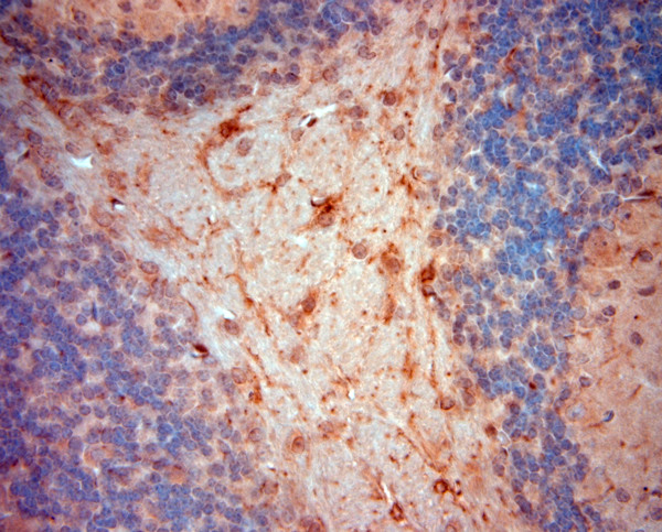 NG2 Antibody in Immunohistochemistry (Paraffin) (IHC (P))