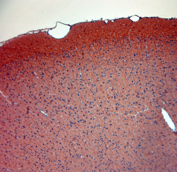 NMDAR1 Antibody in Immunohistochemistry (Paraffin) (IHC (P))