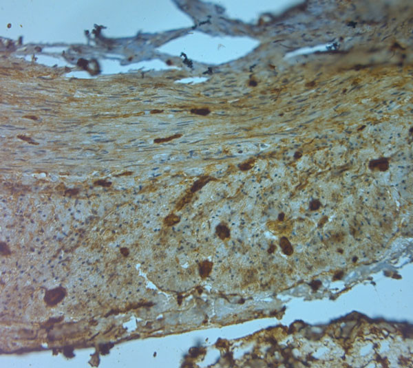 NMDAR3A Antibody in Immunohistochemistry (Paraffin) (IHC (P))