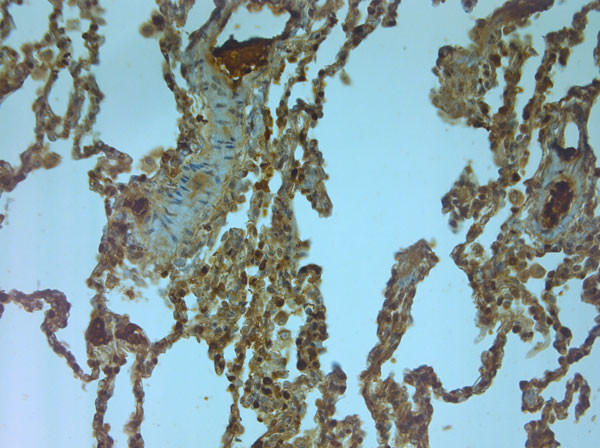 NMDAR3A Antibody in Immunohistochemistry (Paraffin) (IHC (P))