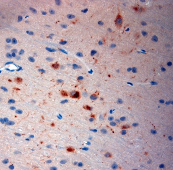 Neurokinin 1 Receptor Antibody in Immunohistochemistry (Paraffin) (IHC (P))