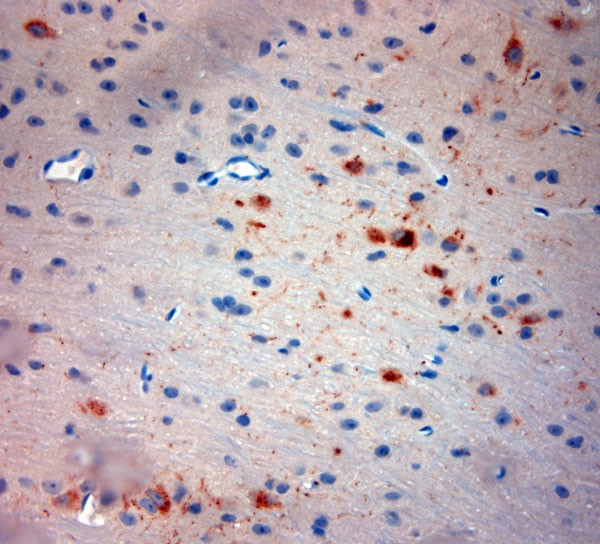 Neurokinin 1 Receptor Antibody in Immunohistochemistry (Paraffin) (IHC (P))