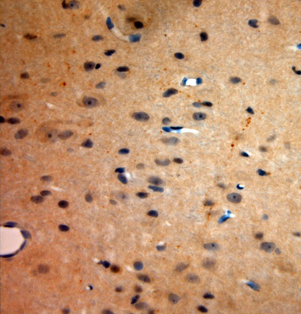 Neurokinin 1 Receptor Antibody in Immunohistochemistry (Paraffin) (IHC (P))