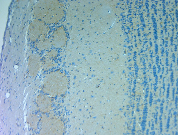 NMDAR3A Antibody in Immunohistochemistry (Paraffin) (IHC (P))