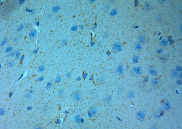 NMDAR3A Antibody in Immunohistochemistry (Paraffin) (IHC (P))