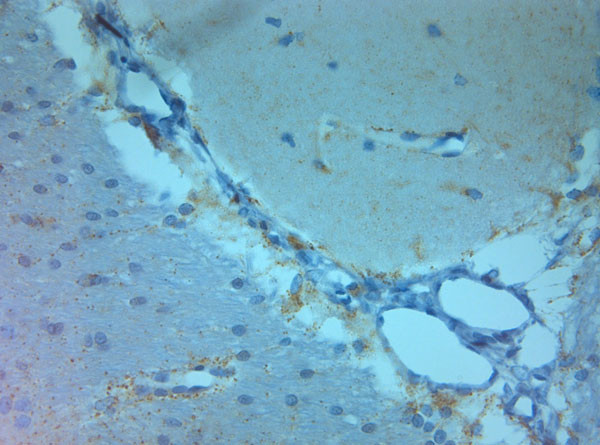 NMDAR3A Antibody in Immunohistochemistry (Paraffin) (IHC (P))