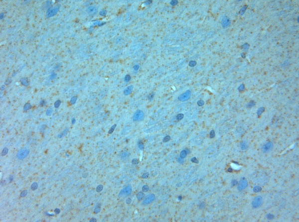 NMDAR3A Antibody in Immunohistochemistry (Paraffin) (IHC (P))