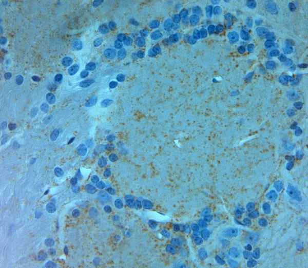 NMDAR3A Antibody in Immunohistochemistry (Paraffin) (IHC (P))