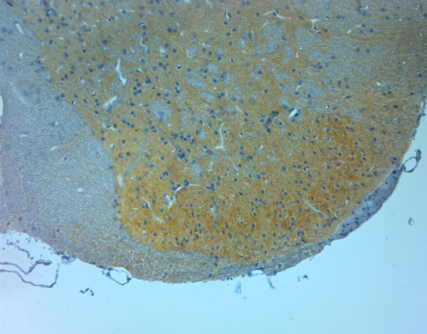 NMDAR3A Antibody in Immunohistochemistry (Paraffin) (IHC (P))