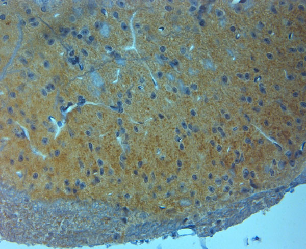 NMDAR3A Antibody in Immunohistochemistry (Paraffin) (IHC (P))