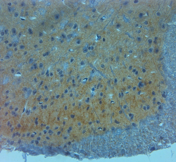 NMDAR3A Antibody in Immunohistochemistry (Paraffin) (IHC (P))