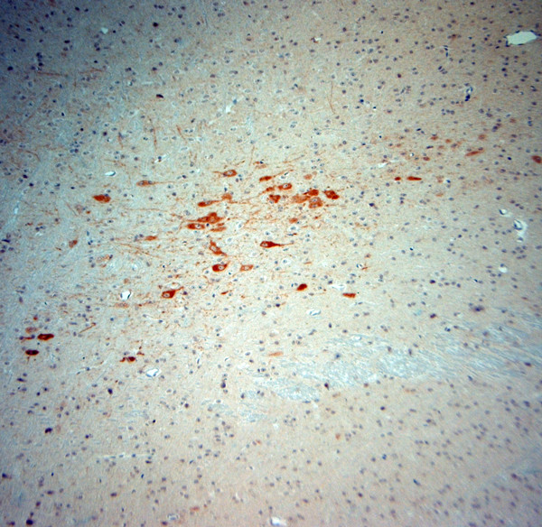 nNOS Antibody in Immunohistochemistry (Paraffin) (IHC (P))