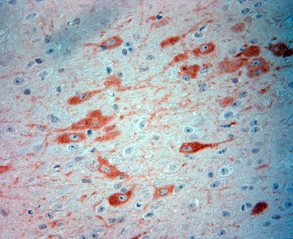 nNOS Antibody in Immunohistochemistry (Paraffin) (IHC (P))